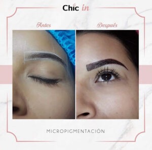 Micropigmentación de cejas antes y después (2)