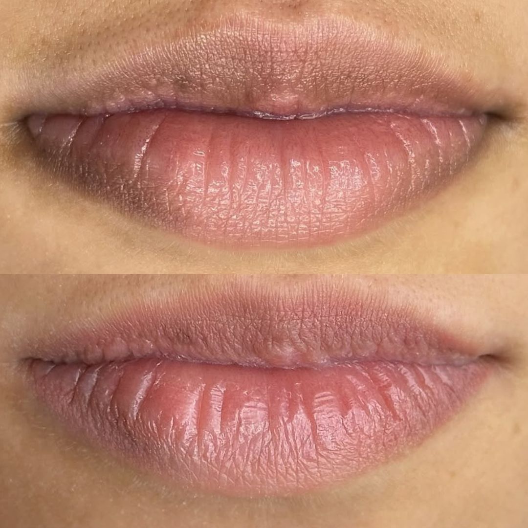 Corrección de color de labios
