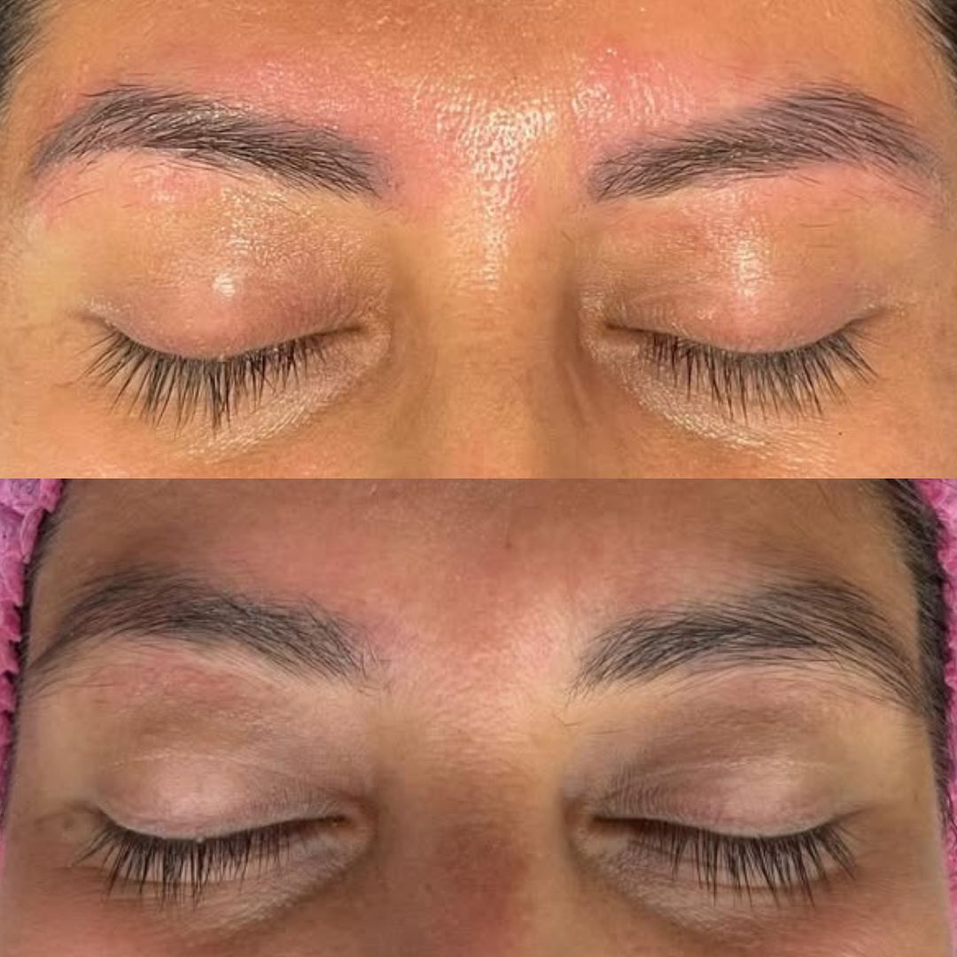 Resultado Microblading Detalle